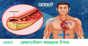 কোলেস্টেরল কমানোর উপায় cholesterol