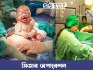 সিজার অপারেশন caesar delivery