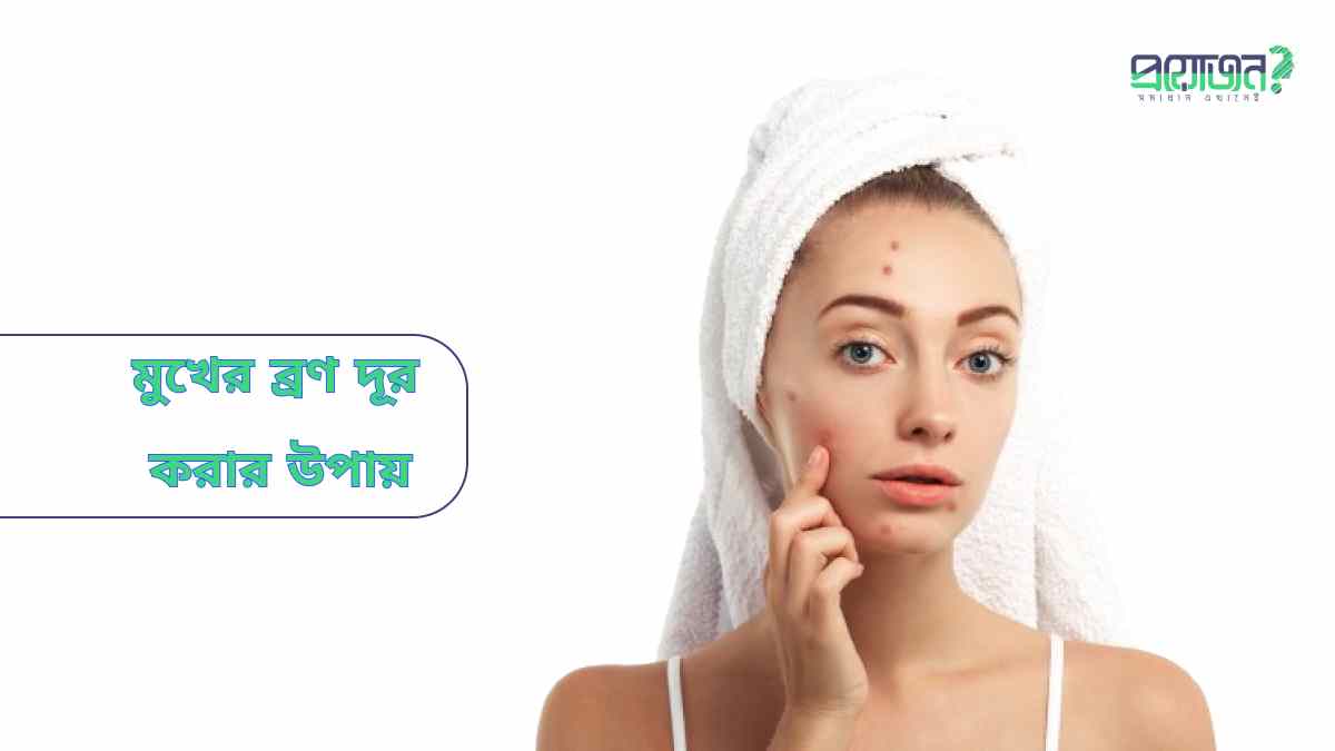 মুখের ব্রণ দূর করার উপায় acne spots remover