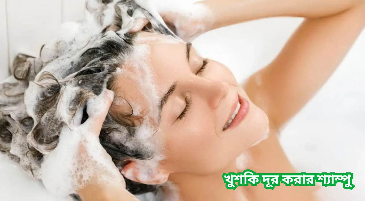 খুশকি দূর করার শ্যাম্পু Khuski dur korar syampoo